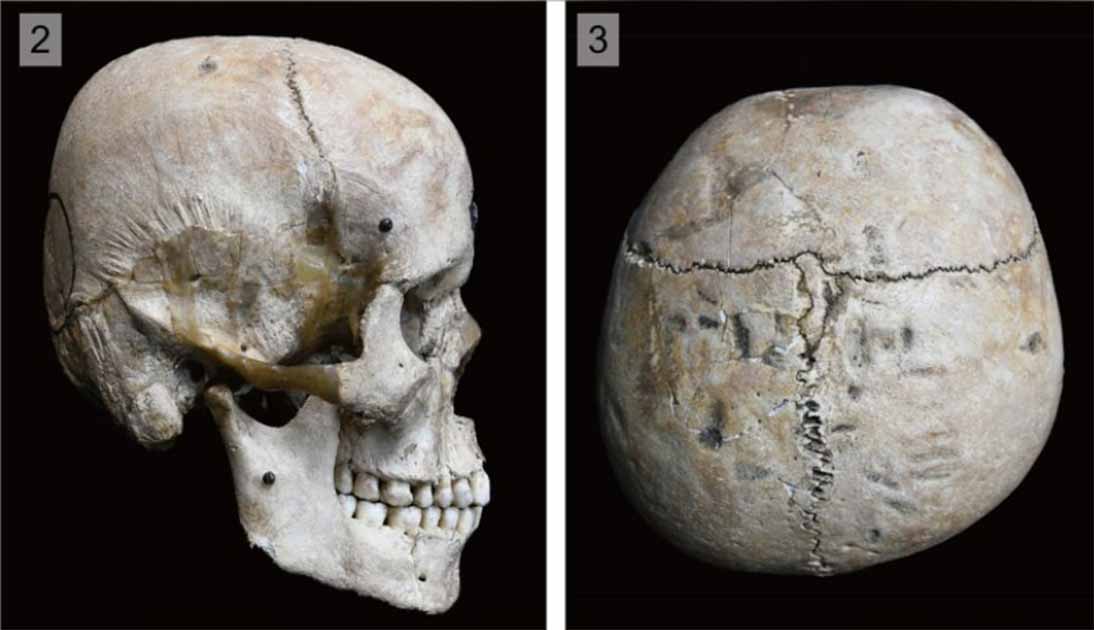 Modified Hirota skull, Japan. Source: Noriko Seguchi/The Kyushu University Museum/PLOS ONE