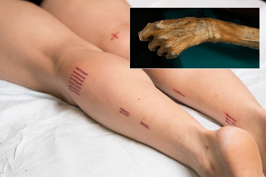 Nicole Wilson had Ötzi the Iceman’s tattoos replicated on her body. Source: TJ Proechel / Nicole Wilson. Inset: Two tattooed bands can be seen around Ötzi the Iceman’s wrist. (South Tyrol Museum of Archaeology) 