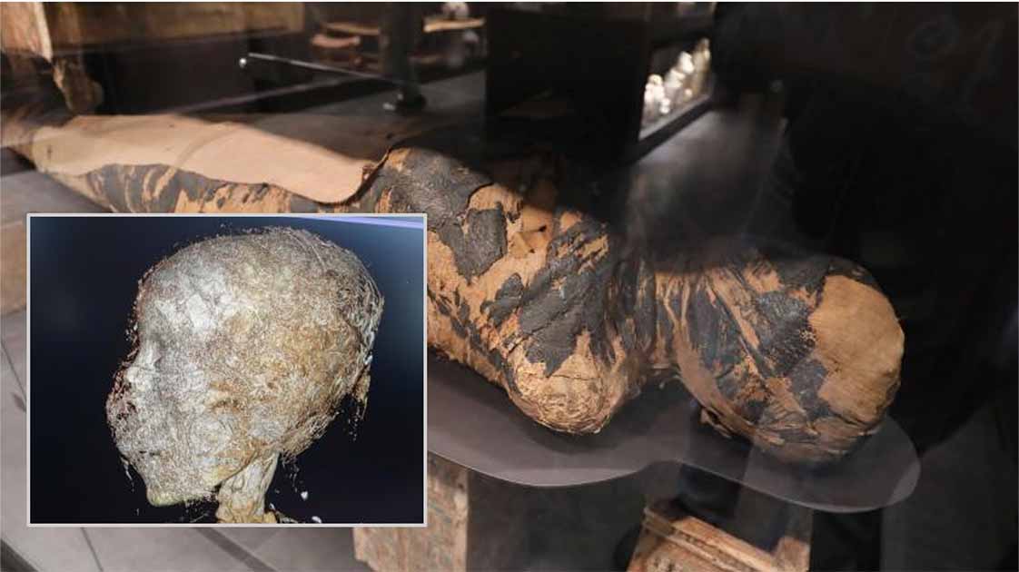Starożytna egipska mumia wykazuje oznaki raka nosa