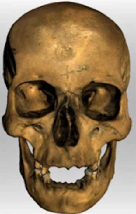 Scans of the skull of Individual A-46 taken by Dr Rynn. (Images: Provided by Gustavo Sánchez Romero)