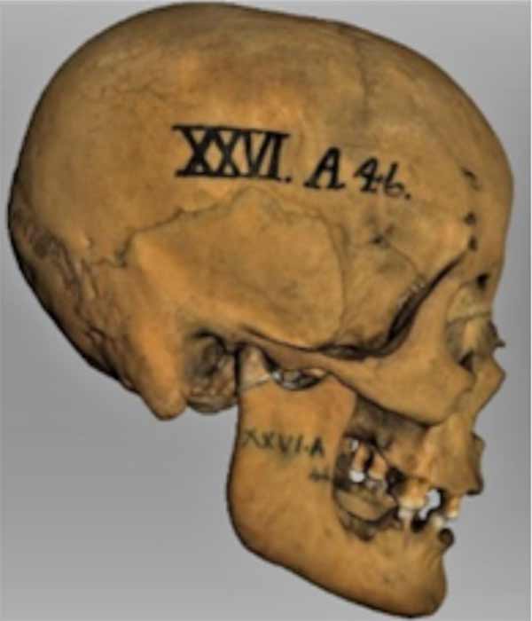 Scans of the skull of Individual A-46 taken by Dr Rynn. (Images: Provided by Gustavo Sánchez Romero)