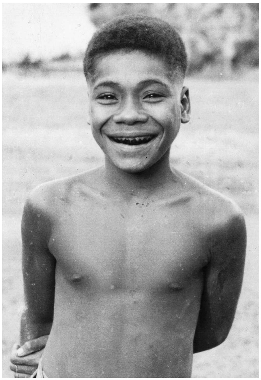 A Sengseng boy displays his recently blackened teeth. Usually, showing one’s teeth was a display of aggression, and, especially in the company of one’s in-laws, care was taken to cover the mouth when laughing