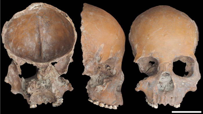 Mask-like facial skull fragment