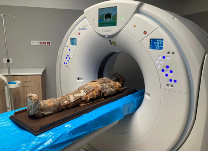 The Egyptian child mummy undergoing a CT scan at a hospital in Lublin, Poland.