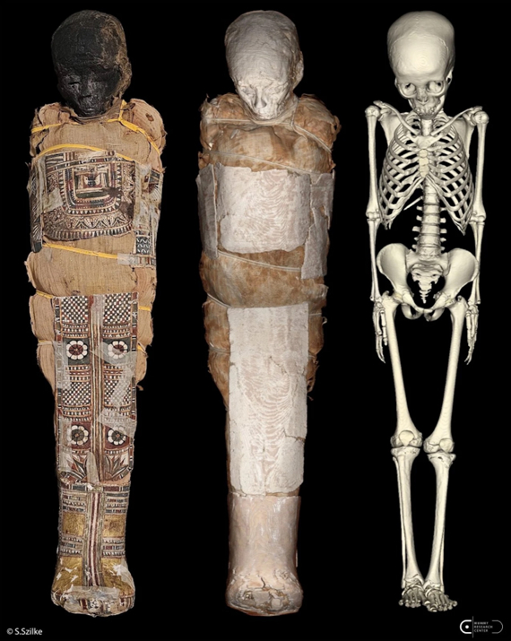 Composite image showing the mummy's cartonnage, the wrapped body, and the skeletal structure revealed by CT scanning