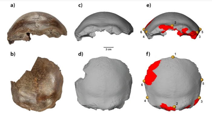 The frontal bone from Hahnöfersand and scans