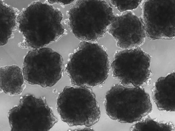 Brain organoids akin to Neanderthal genes