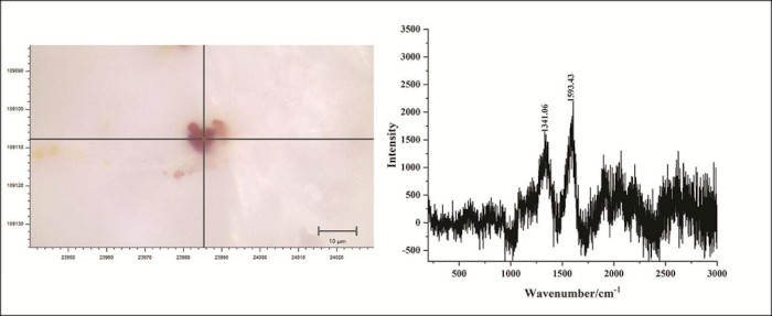 Micro-Raman spectroscopy results showing the structural fingerprint of the red residue found on the surgical tweezers.