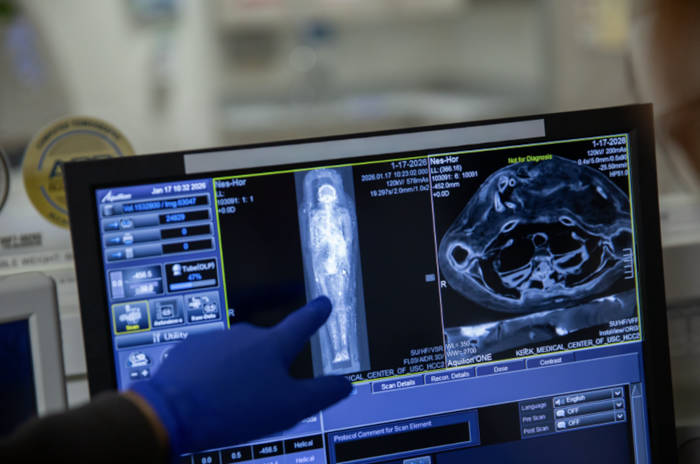 Egyptian mummy Nes-Hor is captured on screen during a full body CT scan 