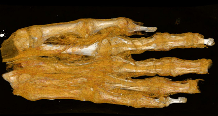 Scan image of a mummified hand.