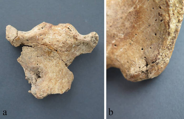Perimortem injuries on skeletal remains 