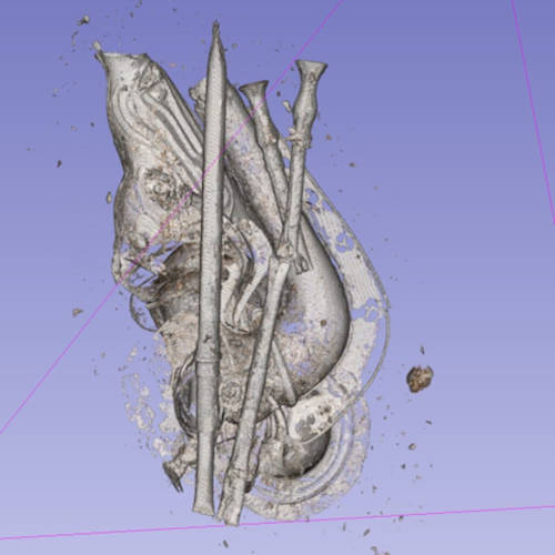 CT scan of the Iron Age hoard.