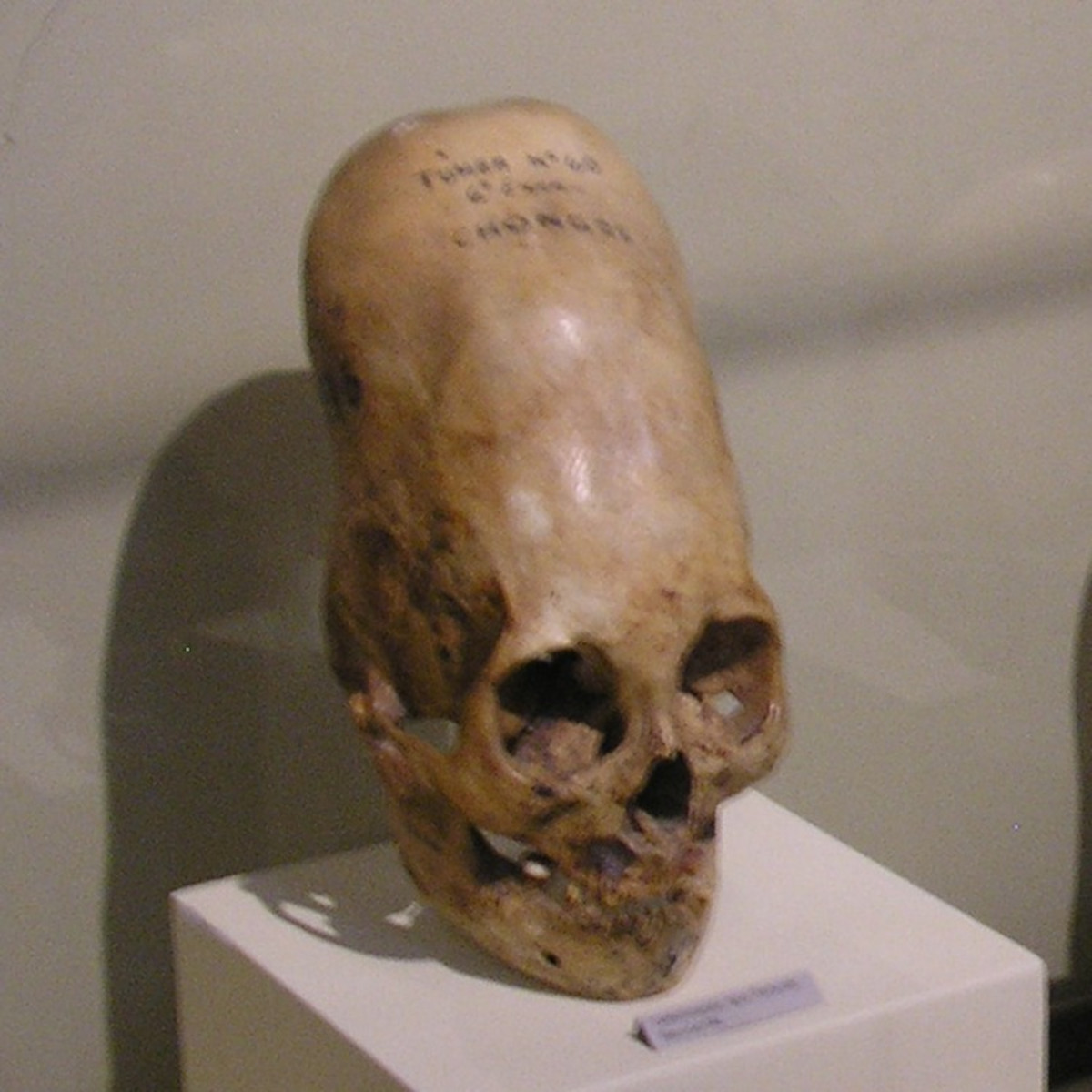 A closer shot of one of the elongated skulls at the Regional Museum of Ica,