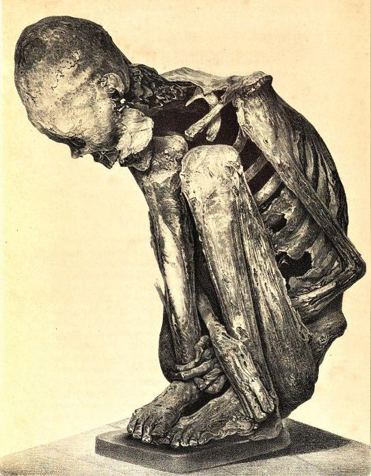 Peruvian mummy of Aymares from the Royal National Museum of Naples, 1871 AD