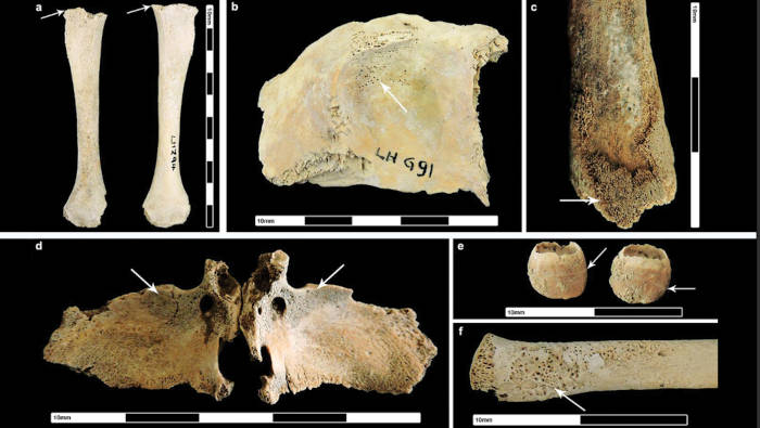 Bones with evidence of Roman non-adult pathology.