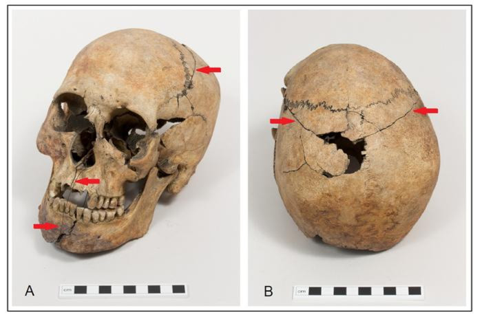Skeleton: the skull, as repaired in 1869.