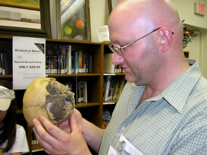 A researcher examining a replica of the anomalous Starchild Skull