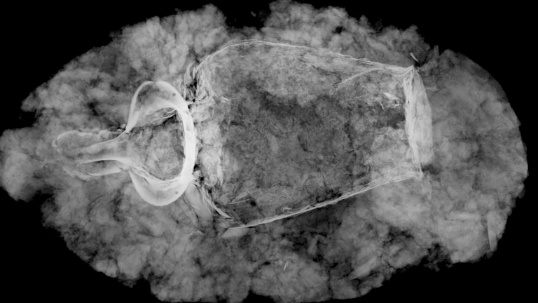Xray image of the Etruscan jug