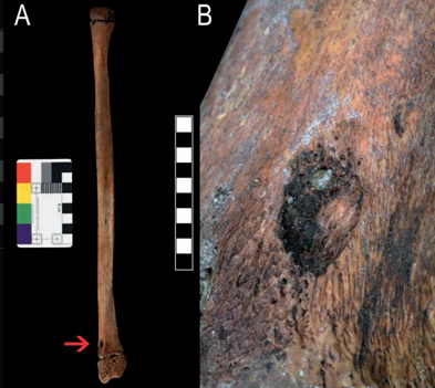 A possible bear bite mark on the right fibula of Il Principe,