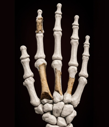 Reconstruction of the Neanderthal hand incorporating the original fossil remains.