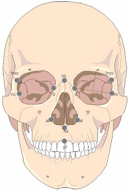 Ubicaciones de puntos de referencia faciales para las mediciones utilizadas en el reciente estudio de Biología del mestizaje entre neandertales y Homo sapiens. (La biología)