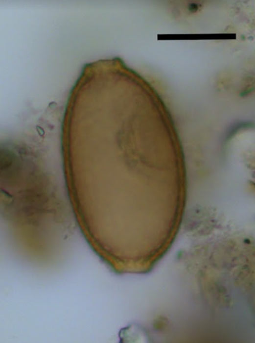 Un huevo de un capilar parásito del coprolito DW12164 en Durrington Walls. (Parasitología)