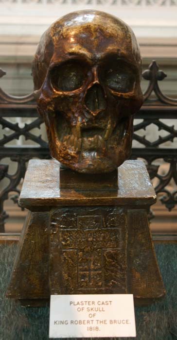 The plaster cast of Robert the Bruce’s skull 