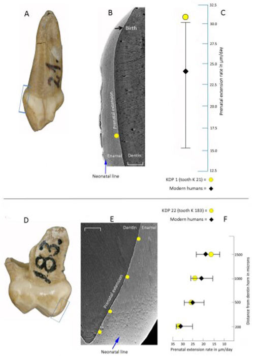 El estudio reciente, basado en cinco dientes de leche encontrados en el sitio de Krapina en Croacia, reveló que el desarrollo infantil de los neandertales era más rápido que el proceso de maduración en los humanos modernos. (Patrick Mahoney y otros / The Royal Society)