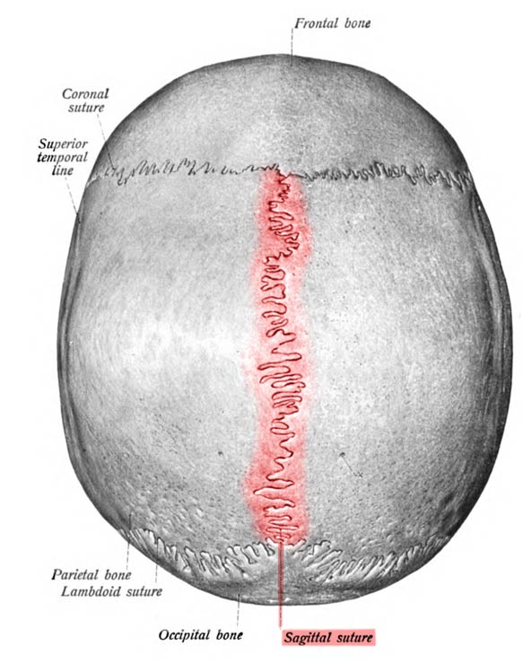 The sagittal suture, highlighted in red, separates the two parietal plates