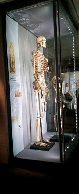 The skeleton of the 7’ 7” (2.13 meters) Charles Byrne as it was exhibited at the Hunterian Museum. (Emőke Dénes/ CC BY-SA 4.0