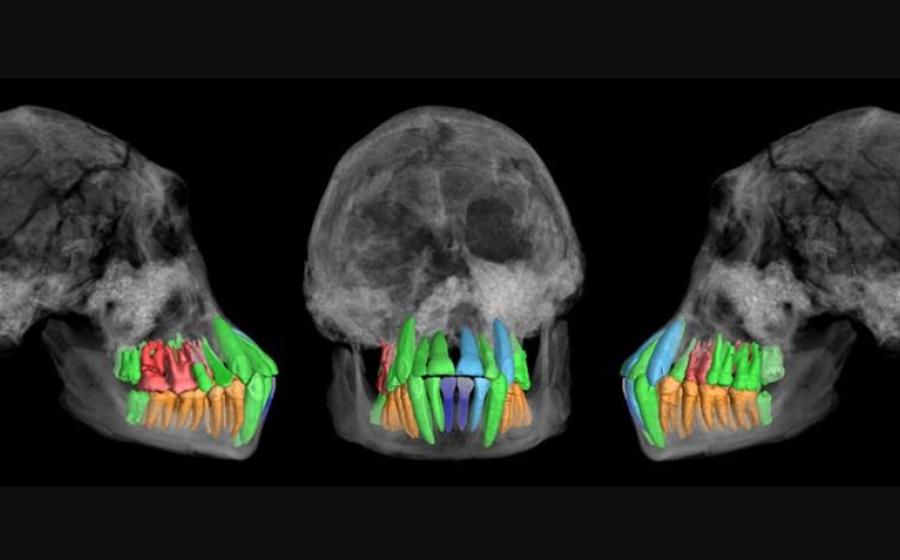 Skull and dentition of a young individual of early Homo from Dmanisi