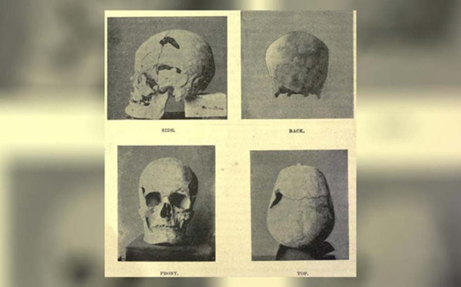 The skull of the Egyptian pharaoh Sa-Nakht, who may have had gigantism