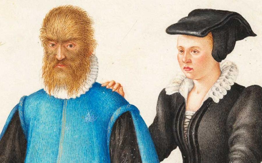 Pedro González and his wife Catherine (c. 1575) by Joris Hoefnagel. Source: Public domain