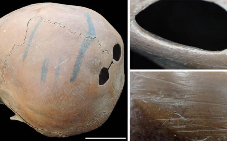 A worked human skull with two precisely drilled perforations in the parietal bones.