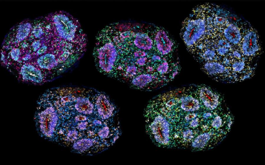Fluorescent microscopy image of human brain organoids.