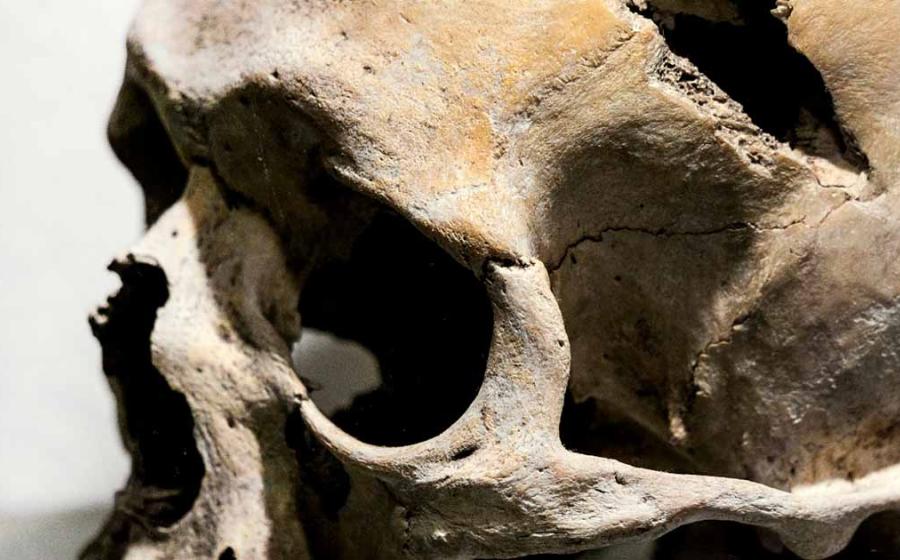 Human skull showing evidence of violence, representational. Source: Vladyslav / Adobe Stock.