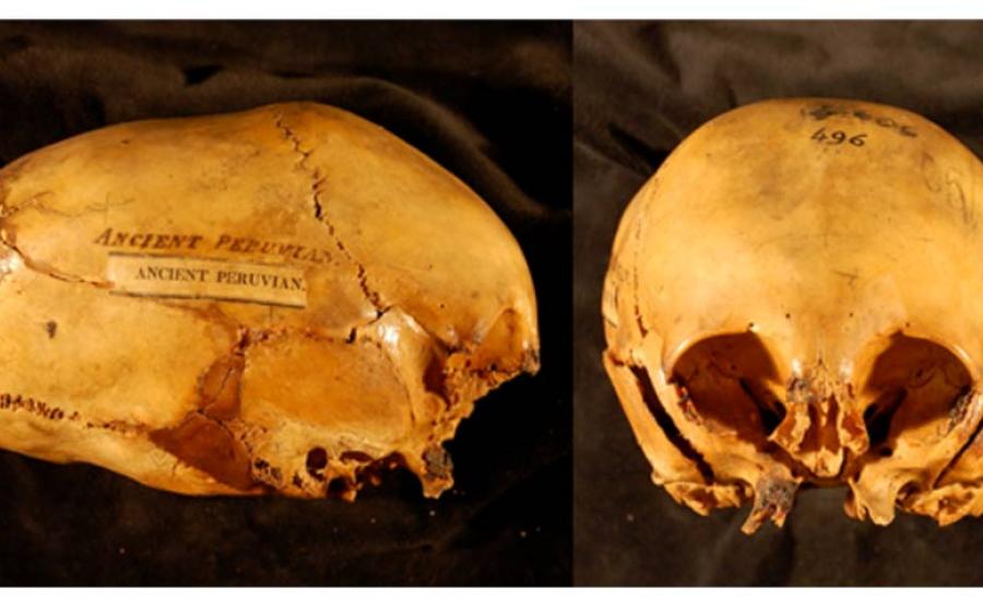 Elongated Skulls in utero - Morton Collection