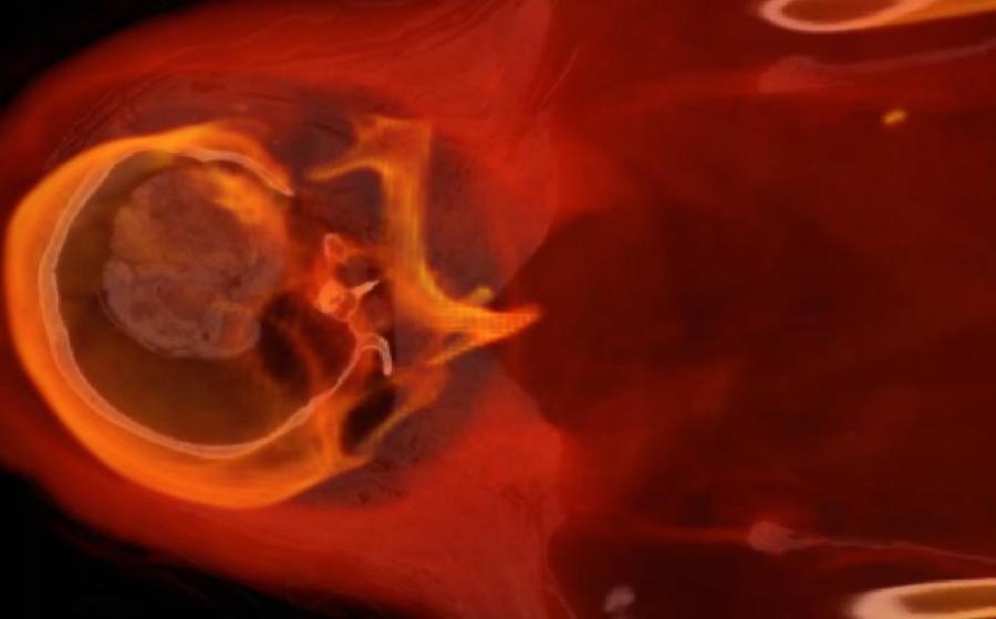 The head and upper thorax of Hatason (Fine Arts Museum of San Francisco)