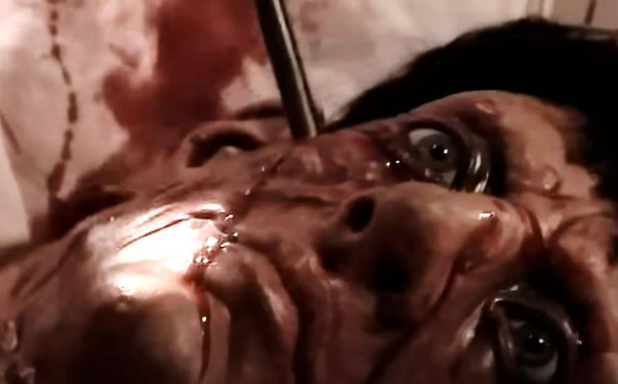 King Henry V arrow removal surgery recreation. Source: YouTube Screenshot / thehistorysquad.