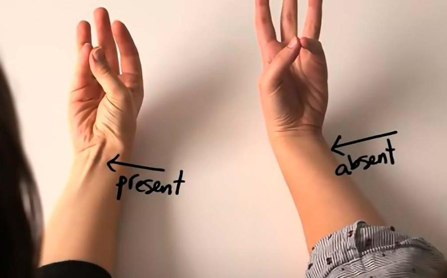 Vestigial muscle in forearm. Source: YouTube Screenshot / Vox.