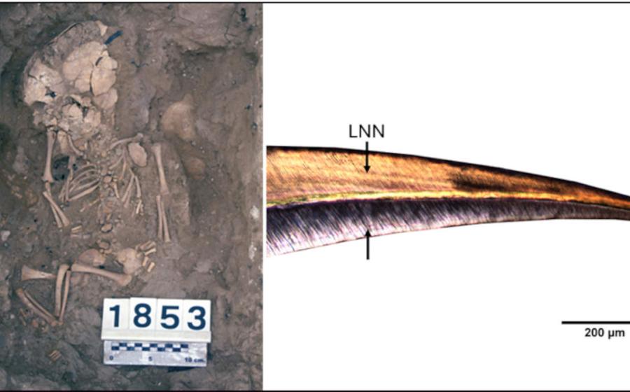 Left, Burial of a perinatal individual from the Fortalesa dels Vilars, Right, baby's central incisor 