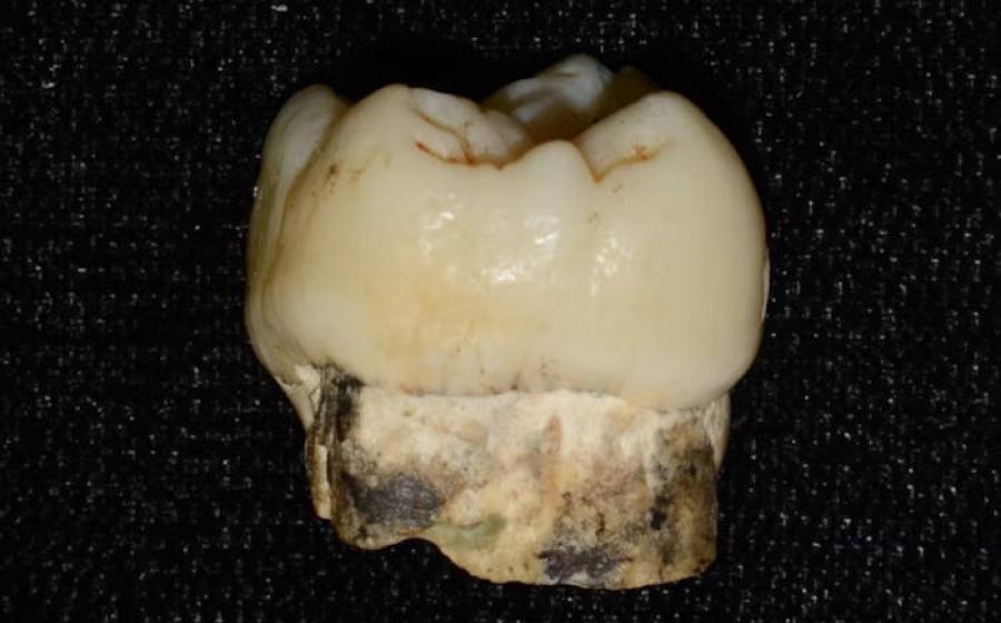A 2 million-year-old tooth of an early human ancestor. 