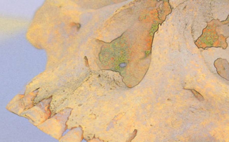 Special imaging of 4,000-year-old skull from which two genomes of Mycobacterium lepromatosis  were sourced.