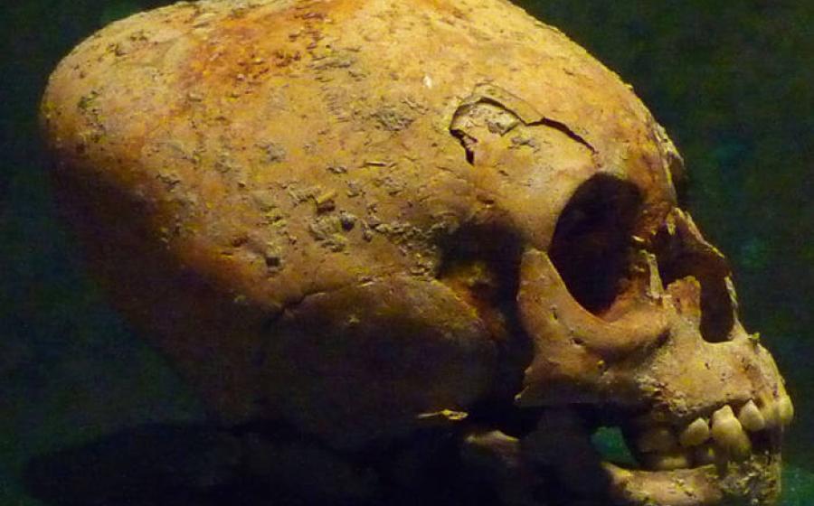 Representative image of a Maya skull with typical more conical style modification.