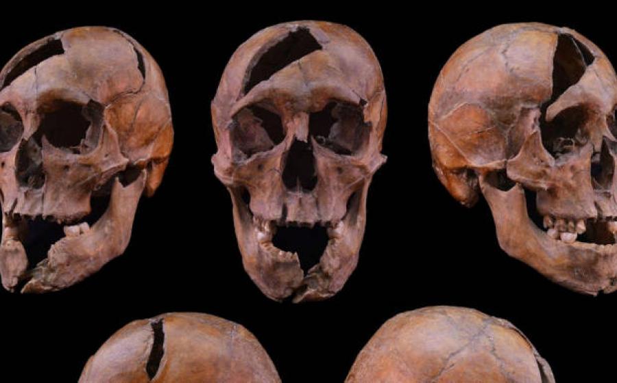 Skull identified as that of Duke Béla of Macsó.