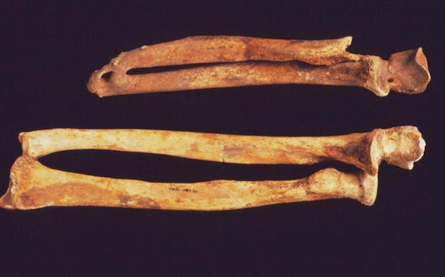 An arm from a body in the cemetery of Ipswich friary