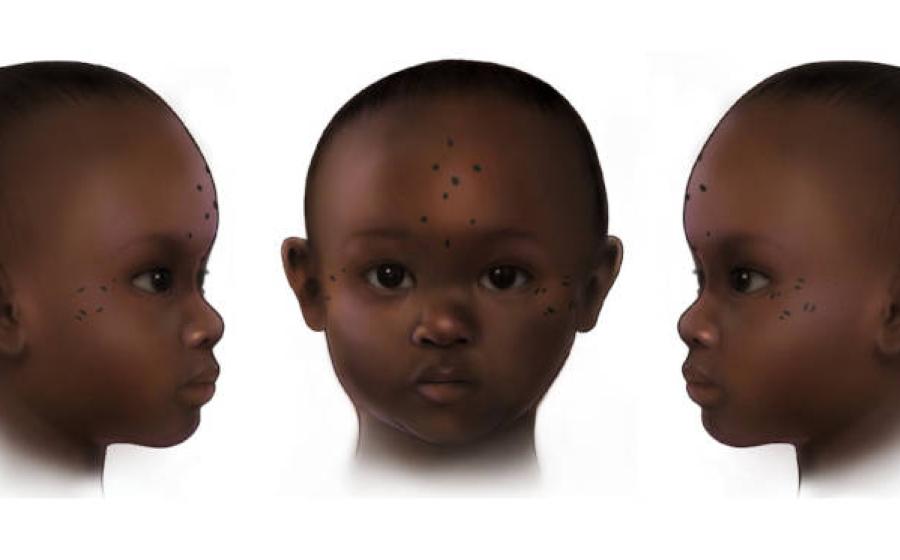 Reconstruction of tattooing on the forehead of a 3-year-old female (657–855 AD) from ancient Nubia.