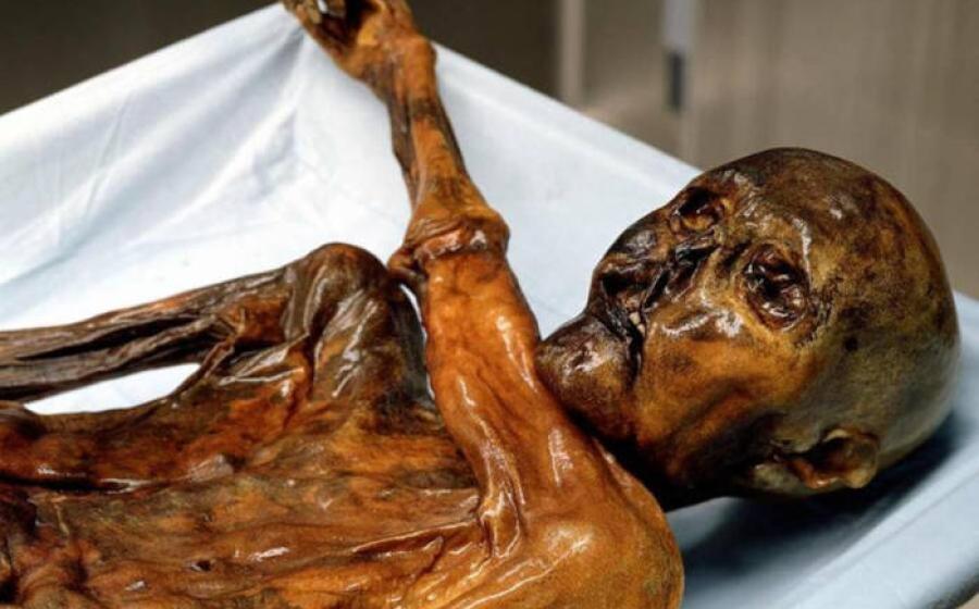 Otzi the Iceman mummy.