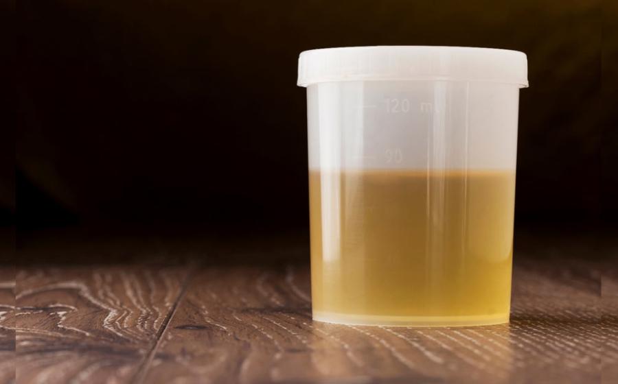 While today we flush our urine away without giving it a second thought, in ancient times it was considered a valuable commodity. Urine contains a wide array of important minerals and chemicals such as phosphorus and potassium. The Romans believed that urine – both human and animal - would make their teeth whiter and keep them from decaying, so they used it as a mouthwash and mixed it with pummis to make toothpaste. In fact, urine was so effective that it was used in toothpastes and mouthwashes up until the 