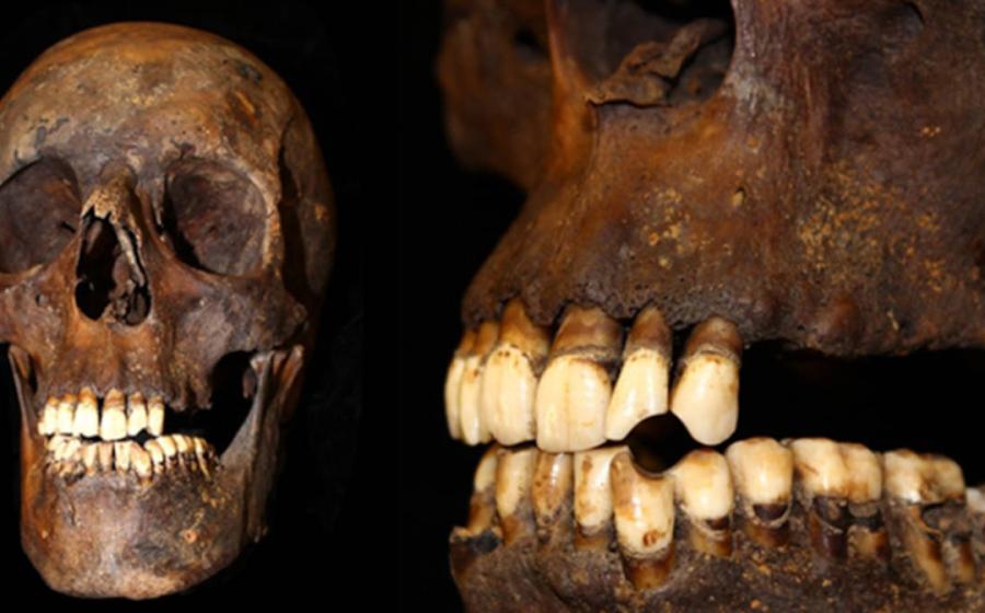 Skull and jaw from the remains used in the study.